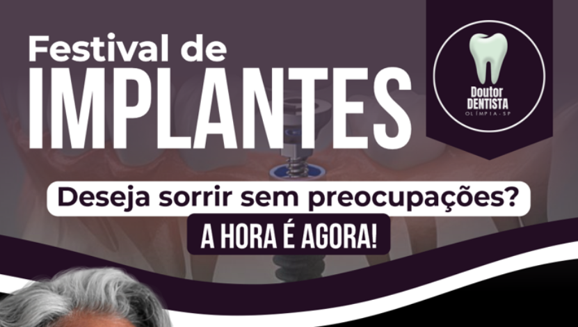 Festival de Implantes – Dr. Dentista 🦷