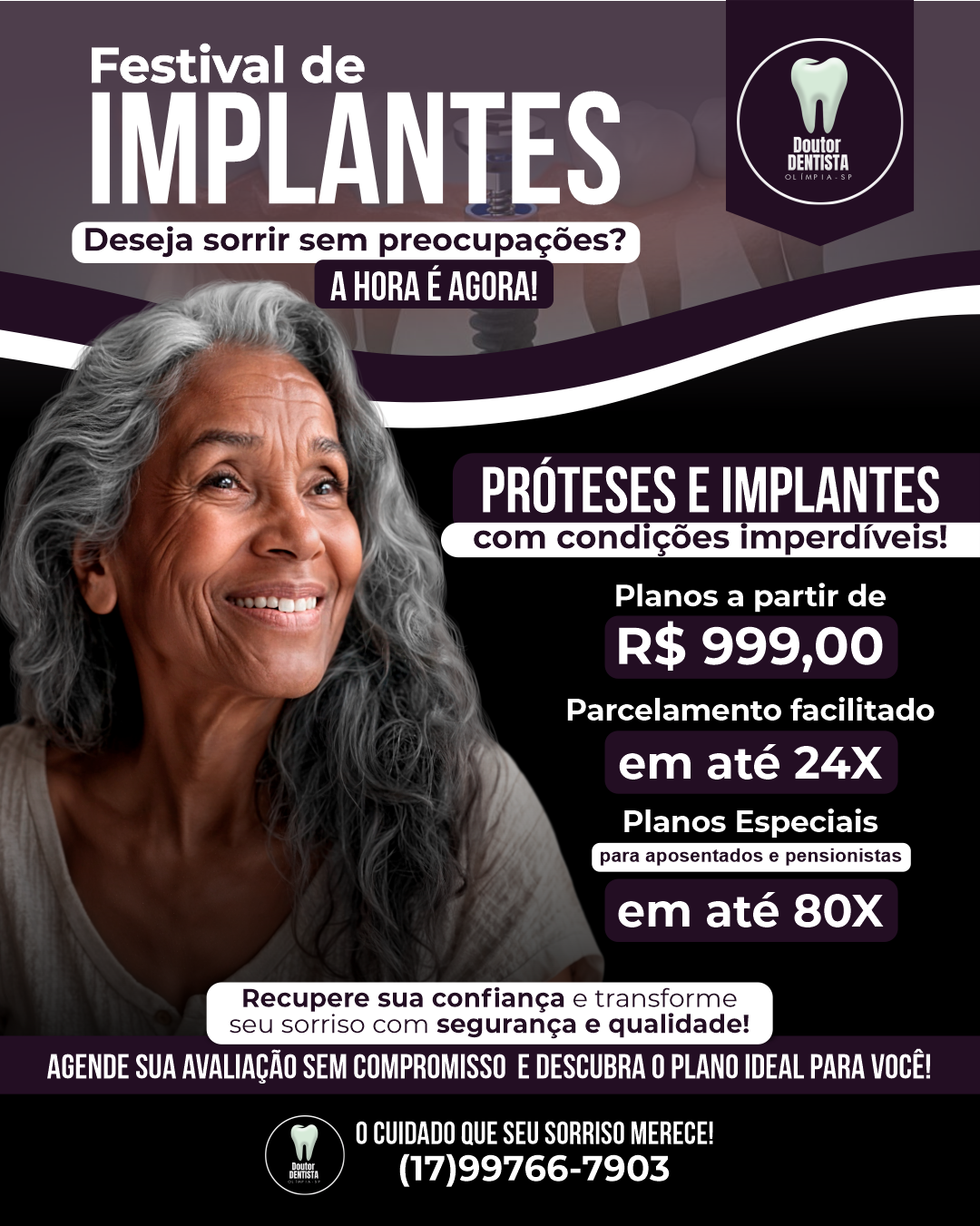 Festival de Implantes